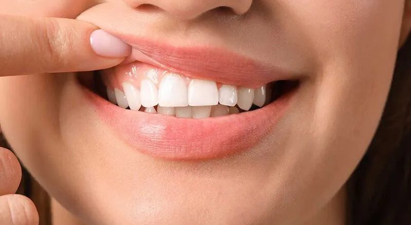 طراحی لبخند در اردبیل