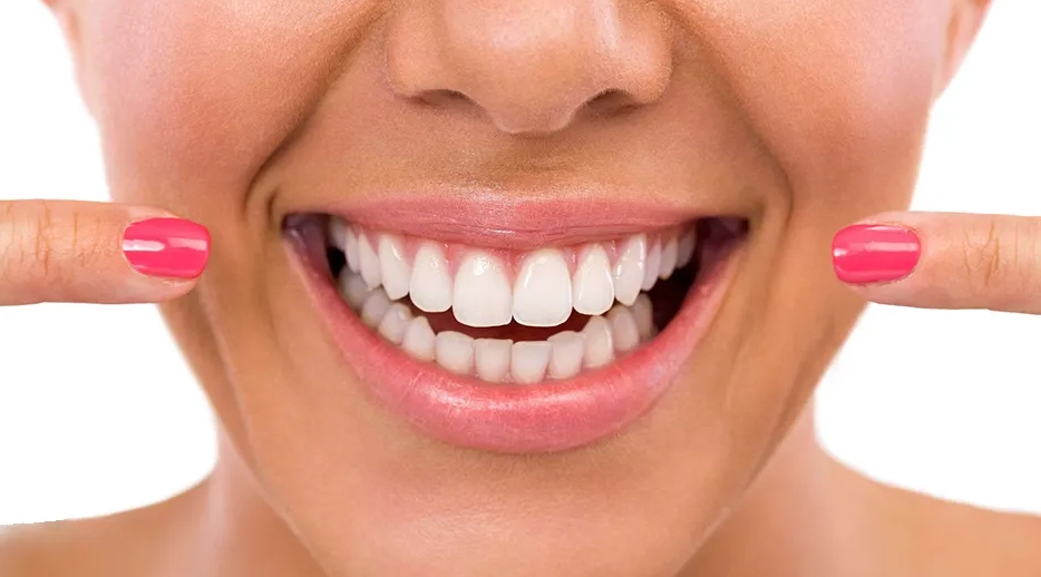 11 اشتباه رایج بعد از انجام لمینت سرامیکی