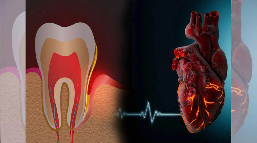 ارتباط بیماری های لثه با بیماری های قلبی؛ آیا سلامت دهان روی قلب تأثیر دارد؟