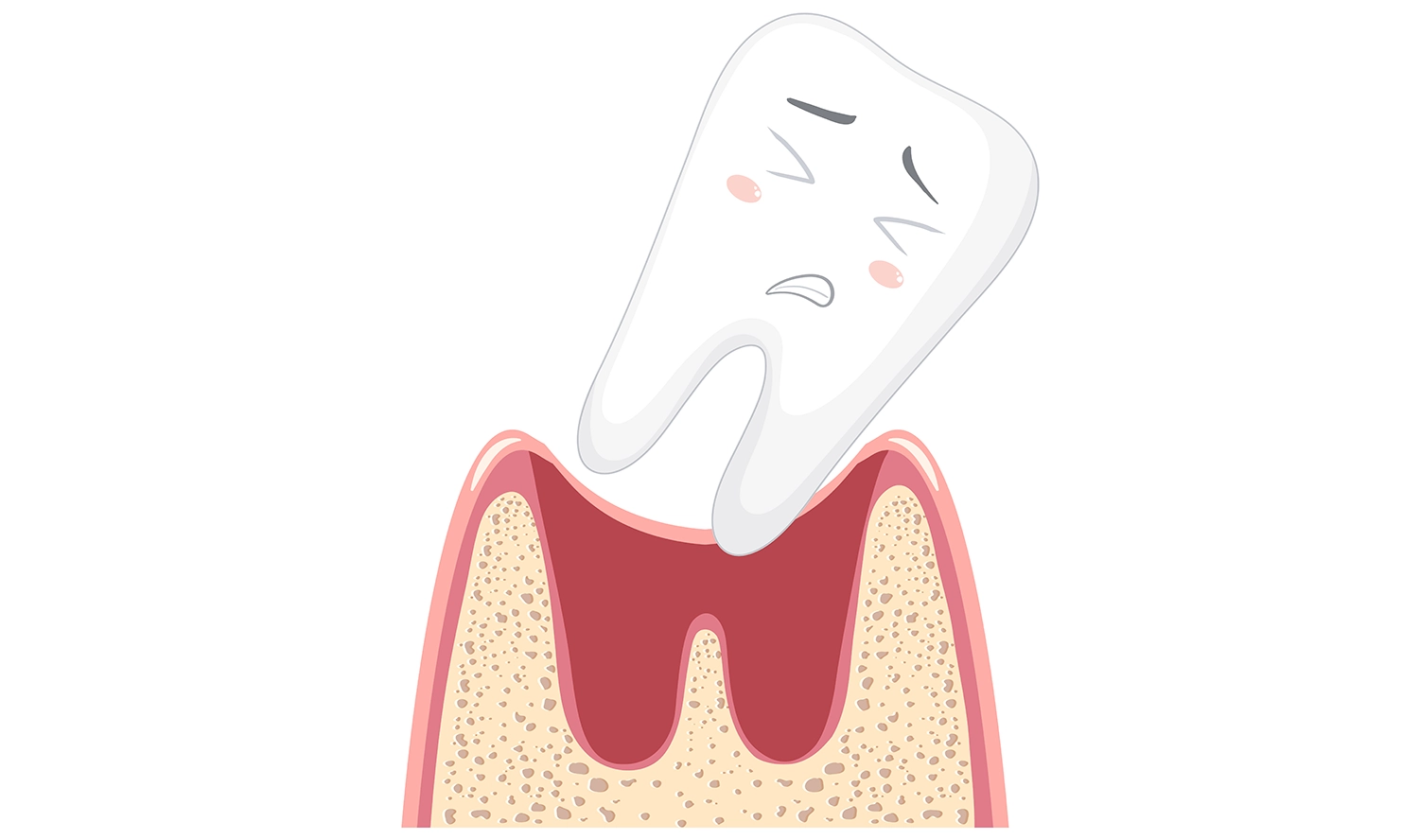 بررسی 8 عارضه جراحی لثه؛ آیا جراحی لثه خطرناک است؟